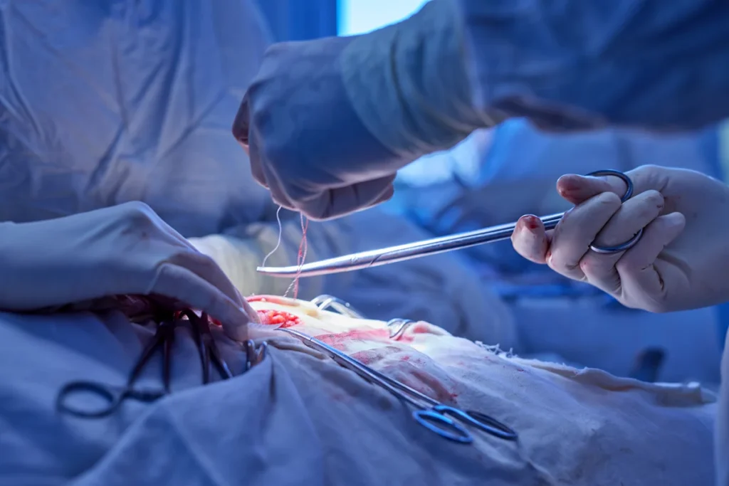 Vascular Surgery